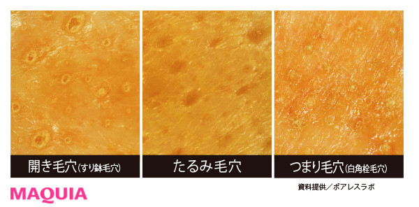 毛穴を目立たせる原因は 気になる毛穴悩みを解決する基本のキ Maquiaメイク Line News