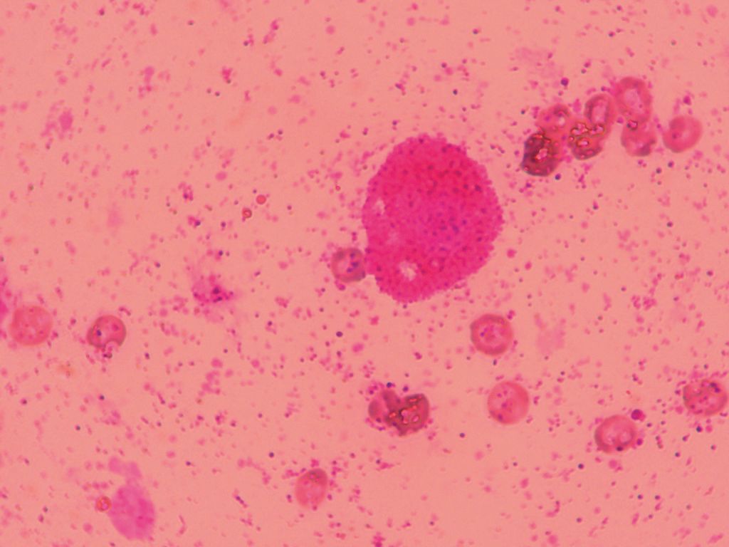 猫が皮膚や内臓にしこり(腫瘍)ができた。疑われる病気は?獣医師が