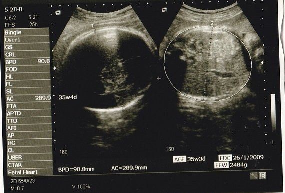 写ったシンボルにびっくり エコー写真で振り返る妊婦生活 たまひよ Online