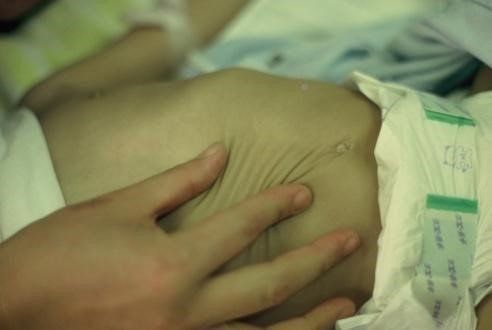 ロタウイルスワクチン 10月の定期化まで待たないで