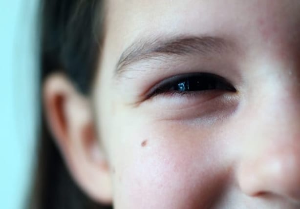 頬にほくろがあるとモテる理由 マイナビウーマン Line News