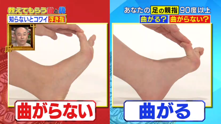 女性の大敵 下半身太り 改善のカギは足の親指にあり Mbsコラム