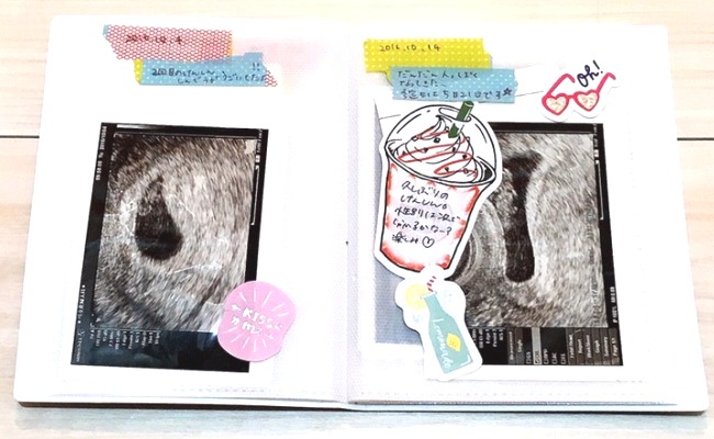 簡単かわいい 頑張らない 私流エコー写真のまとめ方 ベビーカレンダー Line News