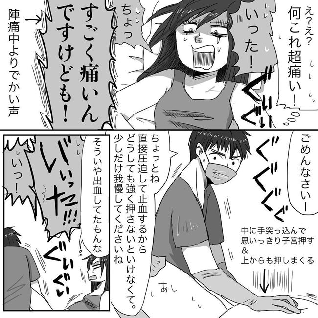 産後もつらすぎ 中が裂けた 縫う え ニシカタ 出産体験談 7 ベビーカレンダー Line News